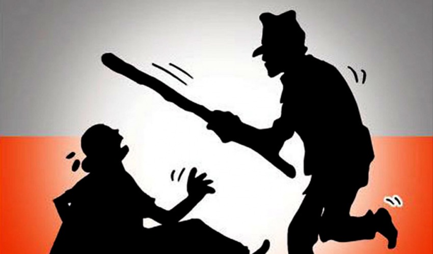 शारिरीक सम्बन्ध राख्न नमानेपछि दलित महिलालाई निर्घात कुटपिट