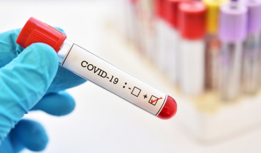 सुदूरपश्चिमका अस्पतालमा १०२ जना कोरोना संक्रमितको उपचार हुँदै