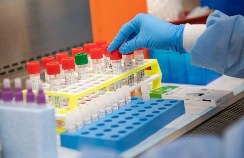 बाजुरामा भिटिएम र आरडिटी किटको अभाब