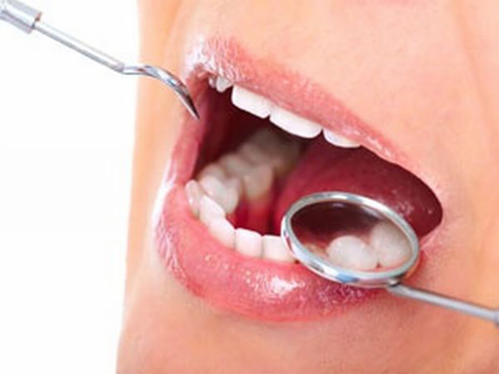 बाजुरा अस्पतालमा दन्त उपचार सेवा सूरु