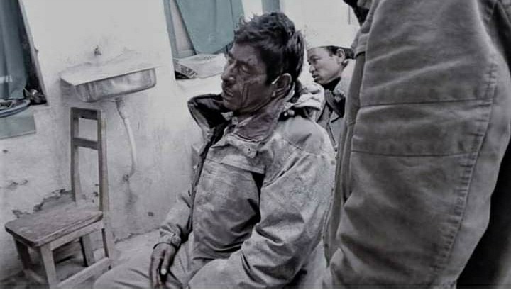 प्रचण्ड-नेपाल र ओली समूहबीच झडप, ओली समुहका वडा अध्यक्षको टाउको फुट्यो