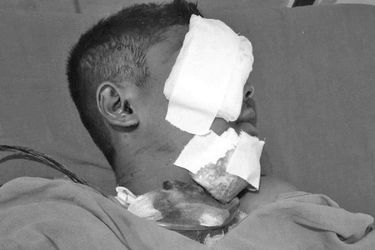 राइफलको गोली लागेर सेनाका जवान गम्भीर घाइते