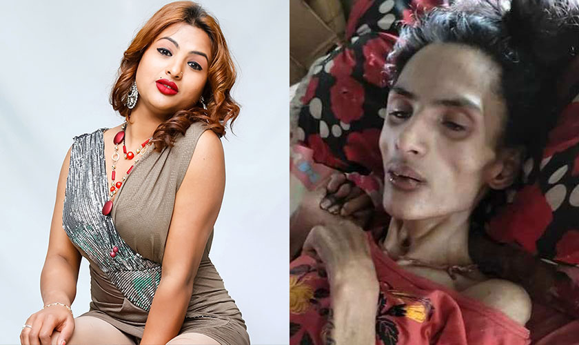 अभिनेत्री निशाको उपचार नर्भिकले निःशुल्क गर्ने