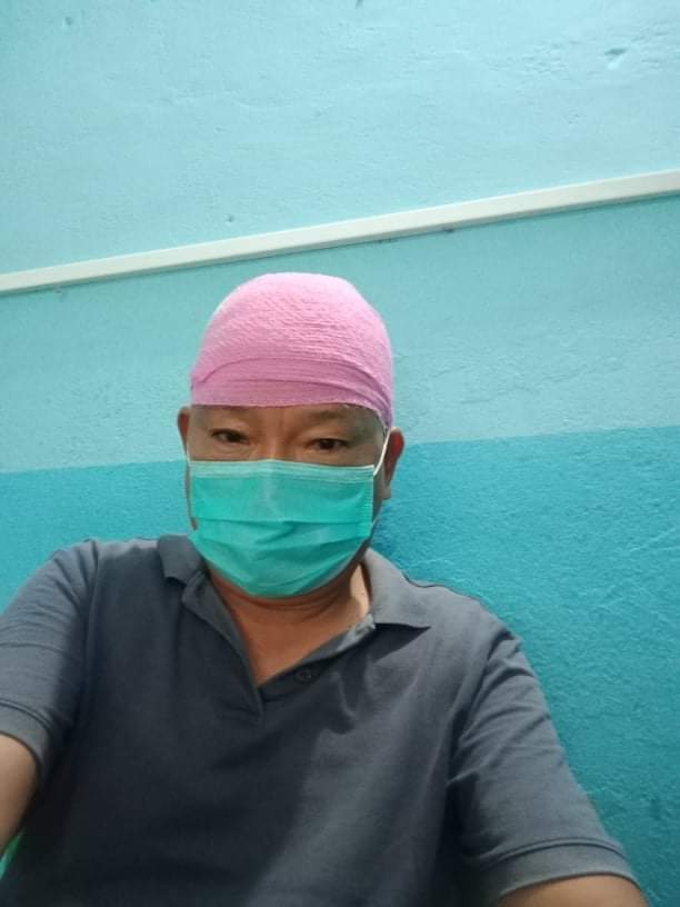 वडाध्यक्षको इटा प्रहारबाट स्थानीय घाइते