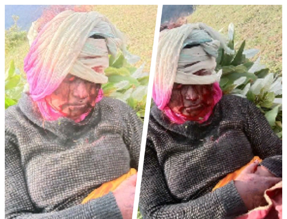 बुढीगंगामा भालुकाे आक्रमणबाट एक युवती घाइते