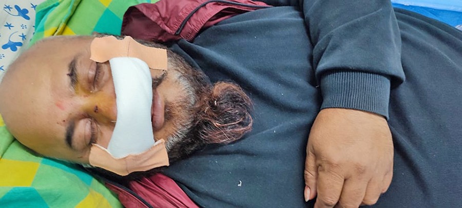 देउवा पक्षबाट पौडेल पक्षका नेता कुटिए