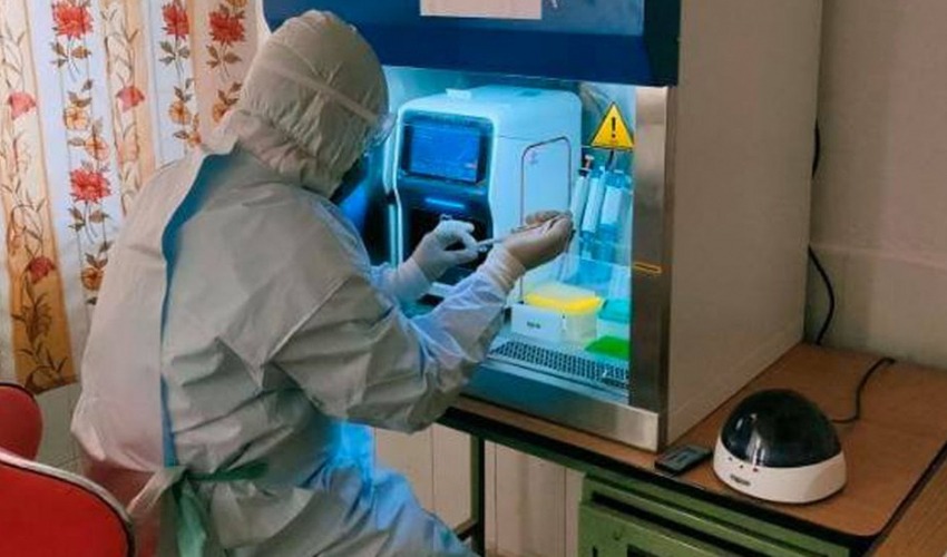 सेती अस्पतालको परीक्षणमा थप २५ जनामा कोरोना पुष्टि