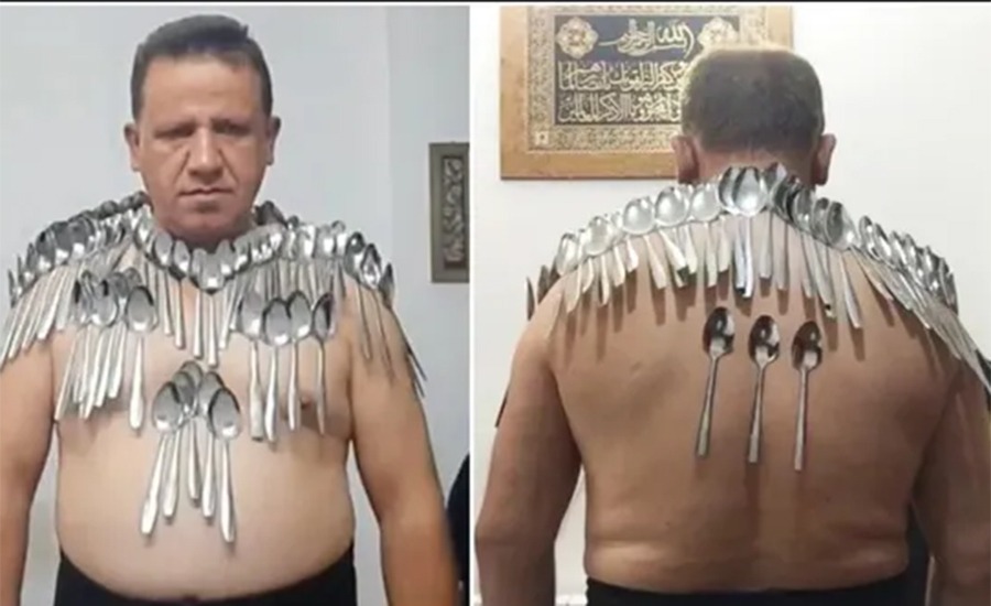 शरीरमा एकसाथ ८५ चम्चा अड्याएर विश्व किर्तिमान (भिडियोसहित)