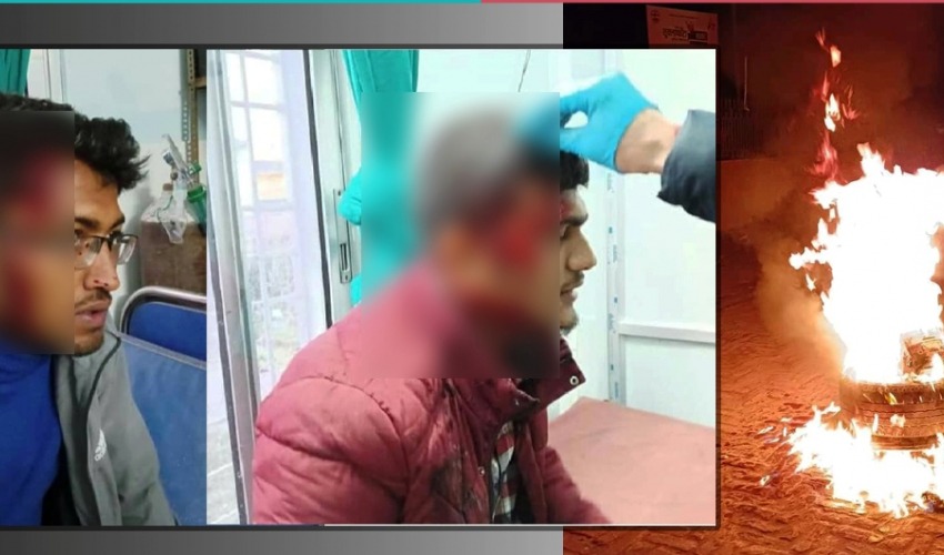 सुदूरपश्चिम बन्द, बन्दकर्तामाथि लाठी चार्ज ,तीन जना घाइते