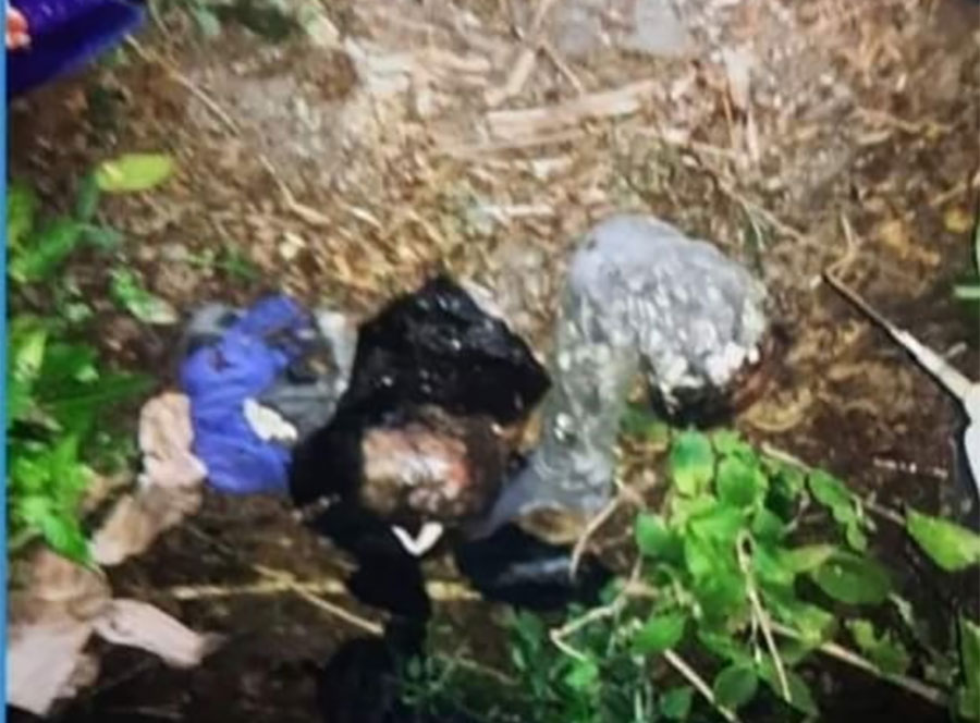 जेब्रा झोलाभित्र मानिसको टाउको र खुट्टा भेटियो