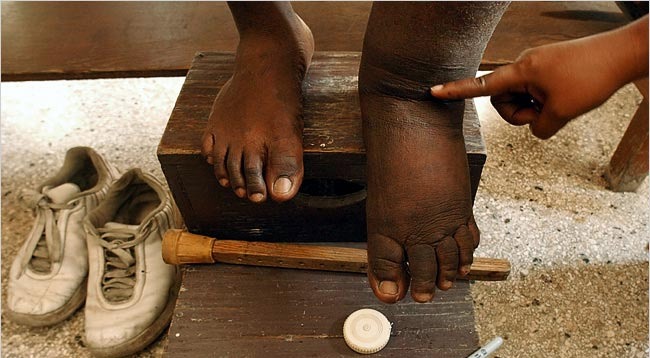 १० जिल्लामा २८ फागुनदेखि हात्तीपाइले विरुद्धको औषधि खुवाइँदै