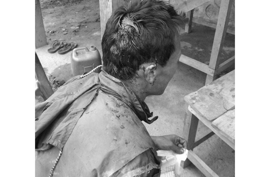 डोल्पाको छार्काताङसोङमा उम्मेदवारी दर्ता गर्न गएका व्यक्ति कुटिए