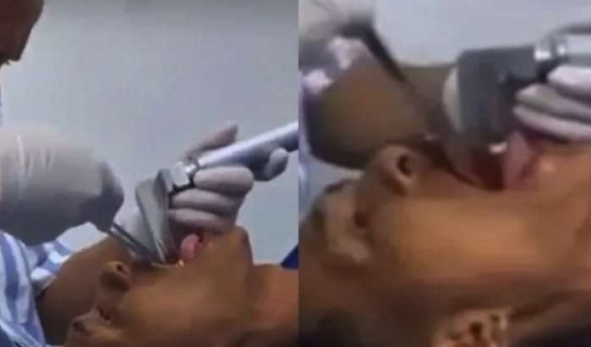 घाँटीमा जिउँदो माछा अड्किएपछि…