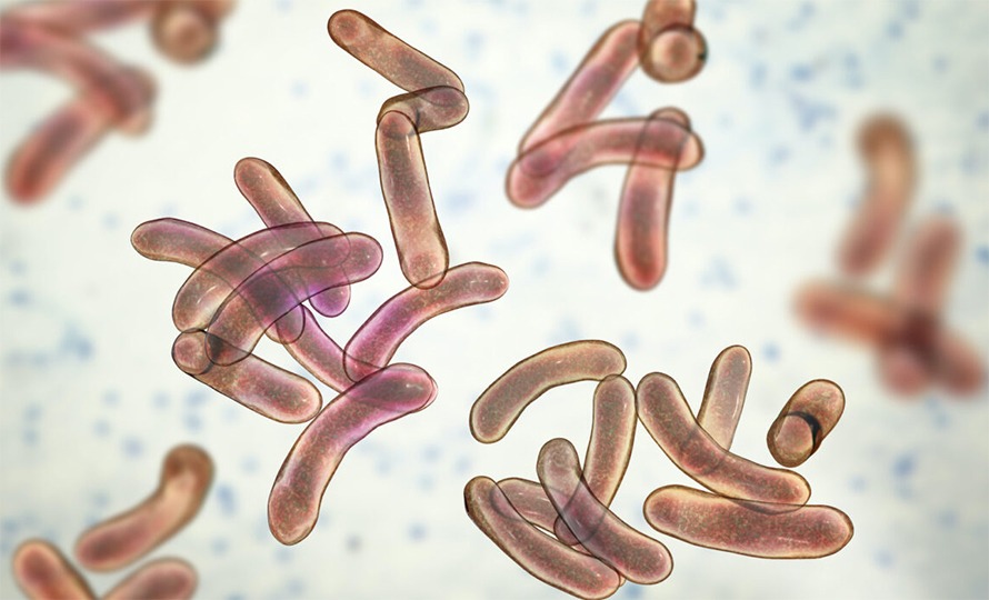 राजधानीमा हैजाको लहर उर्लंदो !