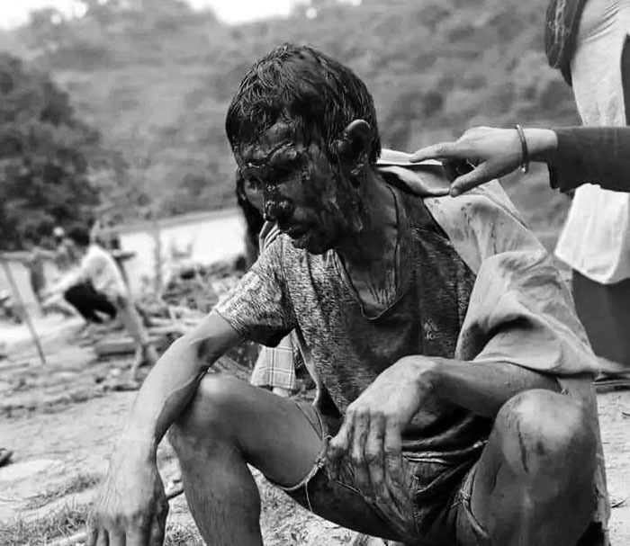 भालुको आक्रमणबाट एक घाइते