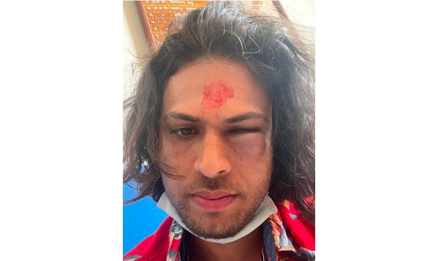 प्रहरीद्वारा विमानस्थलमा कुटिए वैदेशिक राेजगारीमा जान लागेका युवा