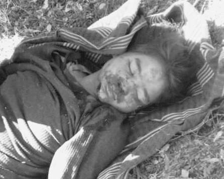 भिरबाट लडेर घाइते भएकि बालिकाको उपचारका क्रममा मृत्यु